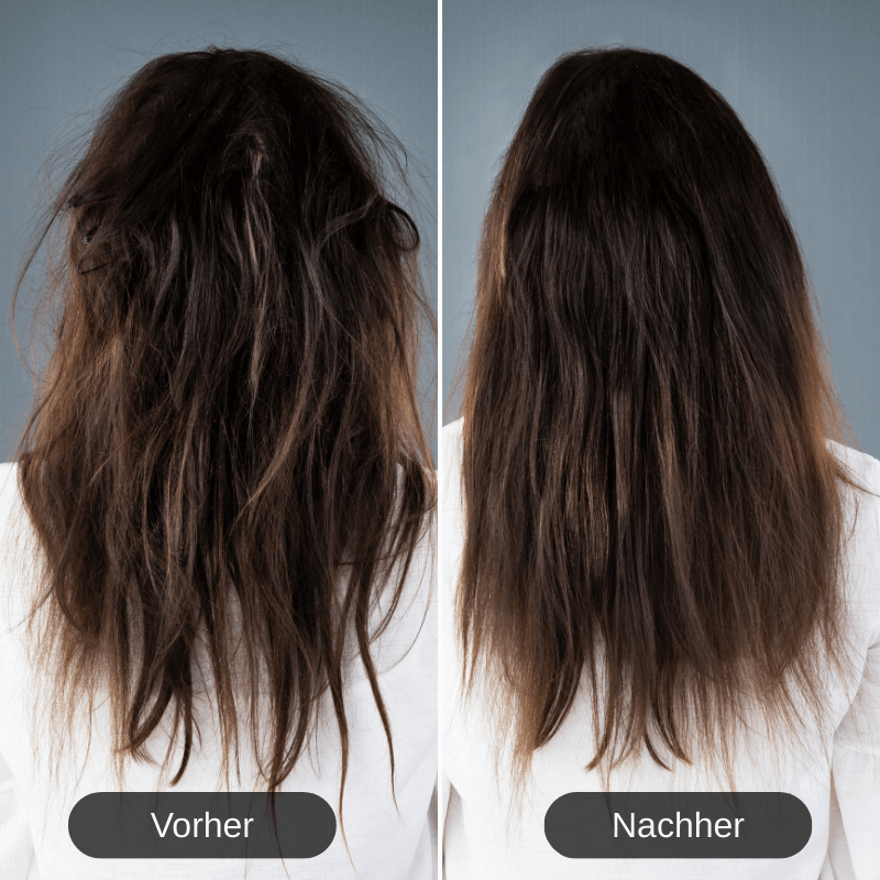 Depilo - 5 in 1 Airstyler