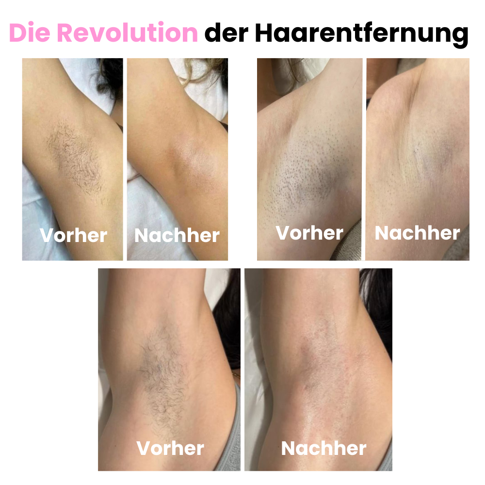 DEPILO – Dauerhaft Haarfrei Bundle