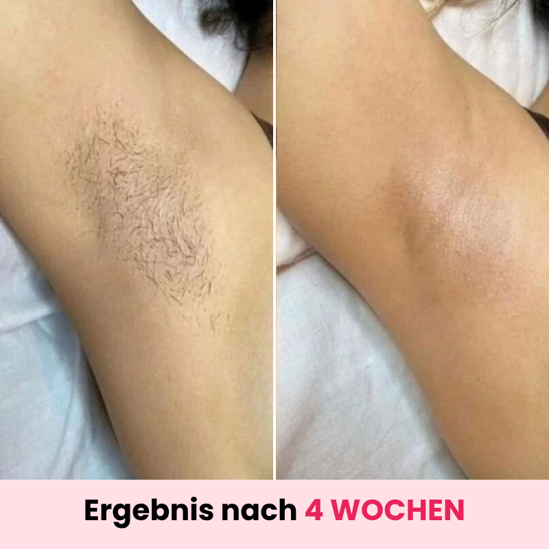 DEPILO – Dauerhaft Haarfrei Bundle