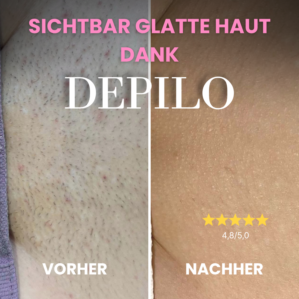 Depilo IPL Max - Dauerhafte Haarentfernung
