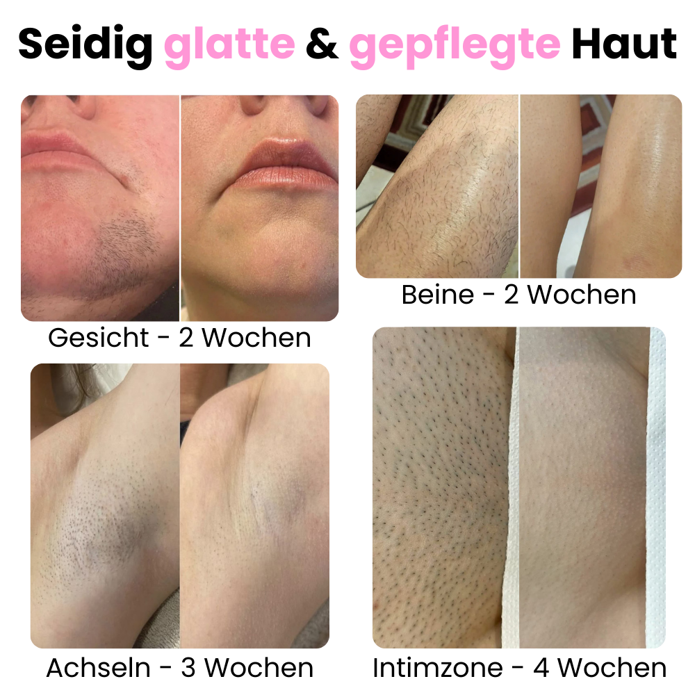 DEPILO – Dauerhaft Haarfrei Bundle