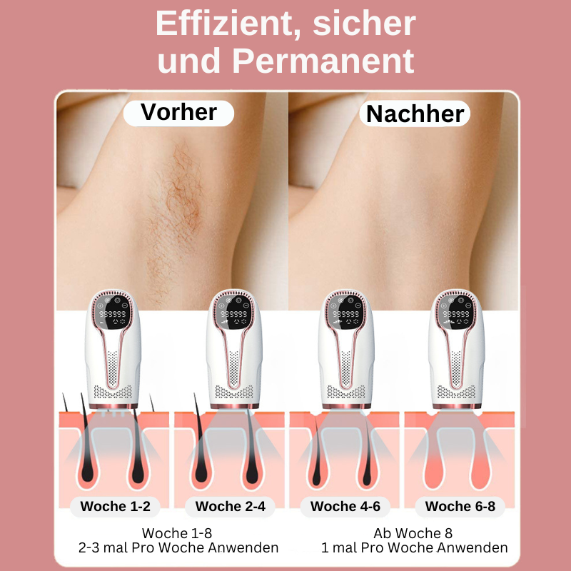 Depilo - Haarentferner
