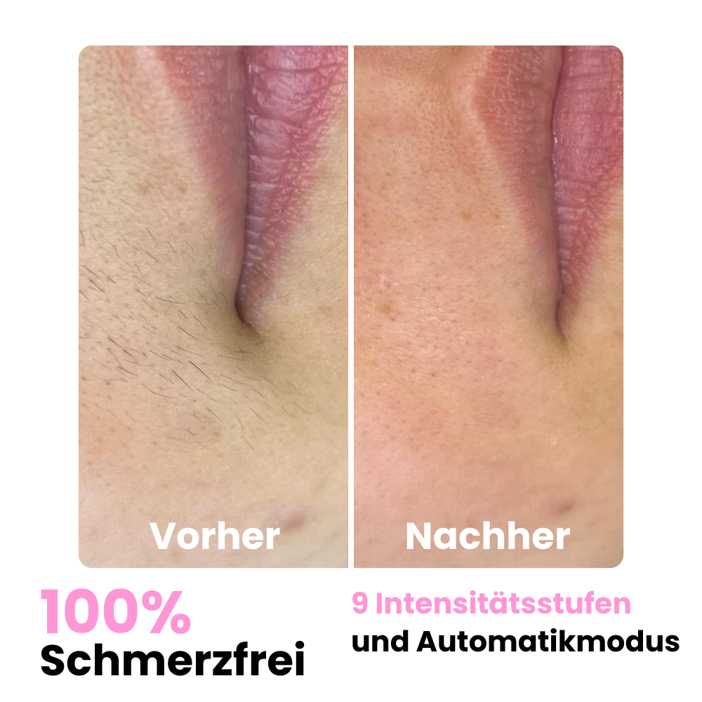 DEPILO – Dauerhaft Haarfrei Bundle