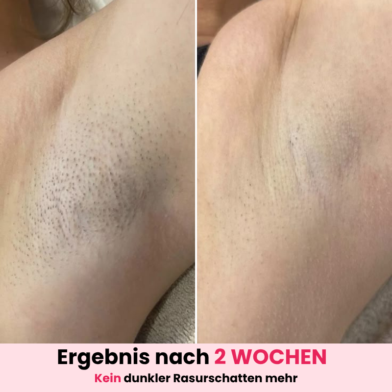 DEPILO – Dauerhaft Haarfrei Bundle