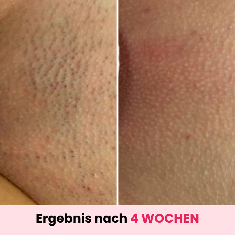 DEPILO – Dauerhaft Haarfrei Bundle