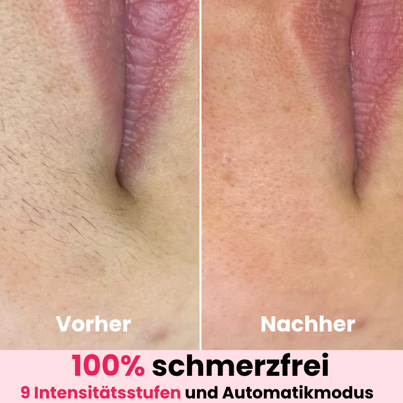 DEPILO – Dauerhaft Haarfrei Bundle