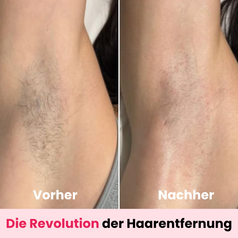 DEPILO – Dauerhaft Haarfrei Bundle