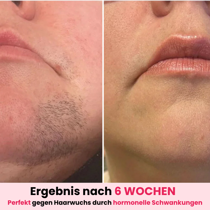 DEPILO – Dauerhaft Haarfrei Bundle